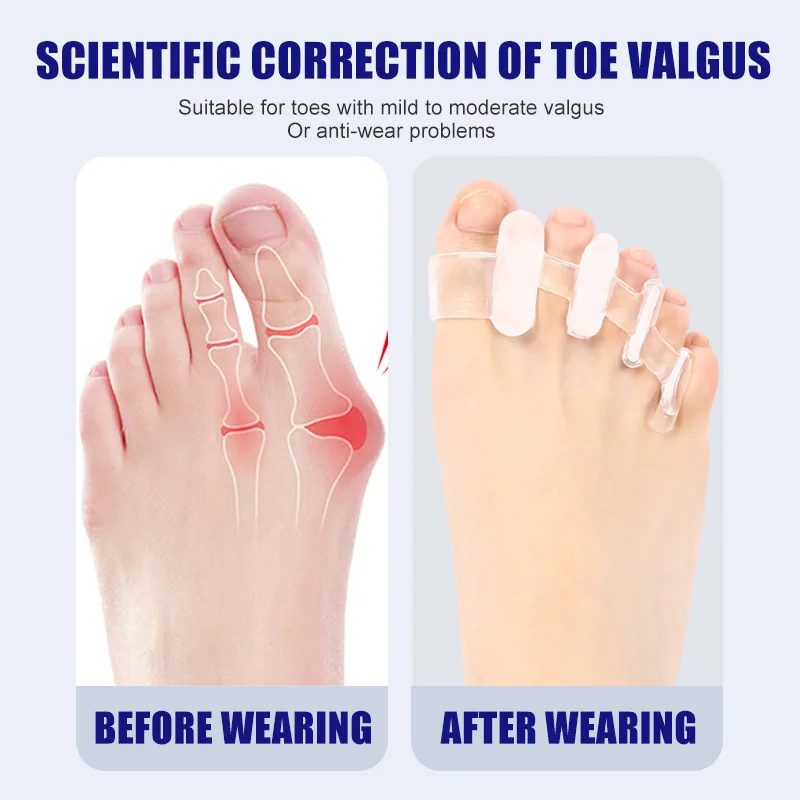 Separador de dedos de silicona - Toe Separator Silicon reseña y precio