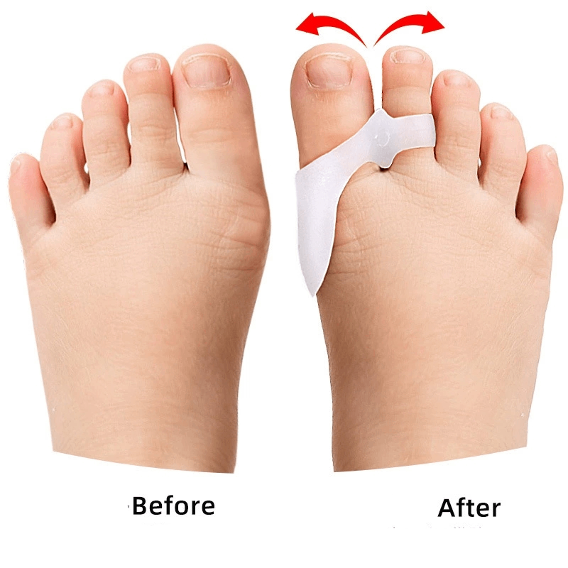 Separador de dedos de los pies - Toe Separator Silicon reseña y precio