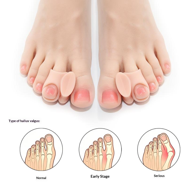 1 Par de Separadores de Dedos  - Toe Separator Silicon reseña y precio