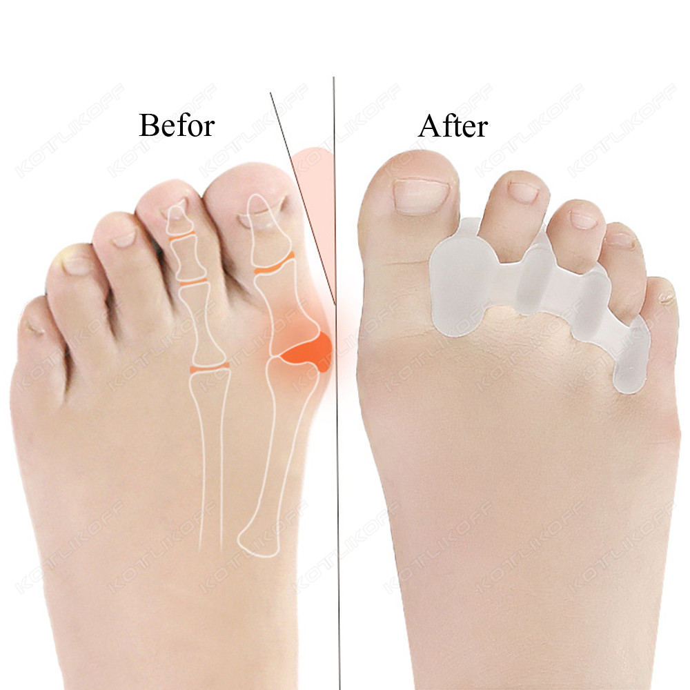 Separador protector de dedos d - Toe Separator Silicon reseña y precio