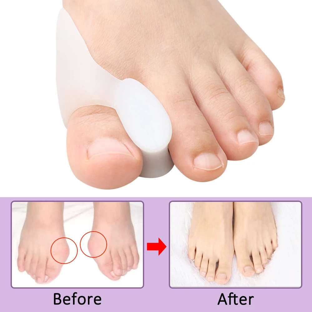 2/4/8 Piezas Separador de Dedo - Toe Separator Silicon reseña y precio